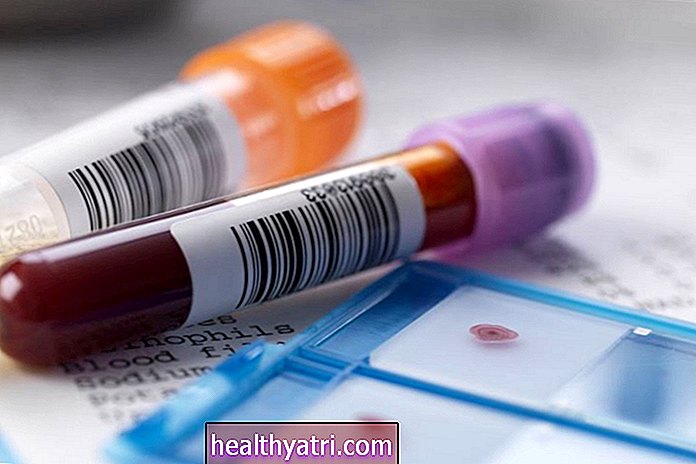 Vai holesterīna tests var būt nepareizs?