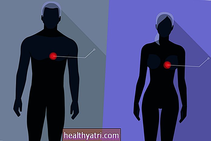 Malattie cardiache: uomini contro donne