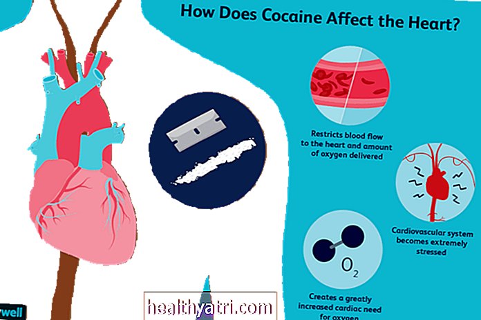 Kaip kokainas veikia širdies ir kraujagyslių sistemą