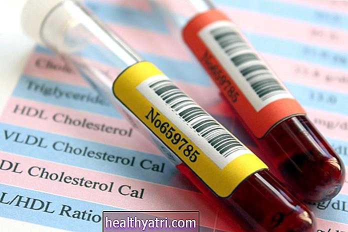 Kuinka perheellinen hypobetalipoproteinemia aiheuttaa matalan kolesterolitason
