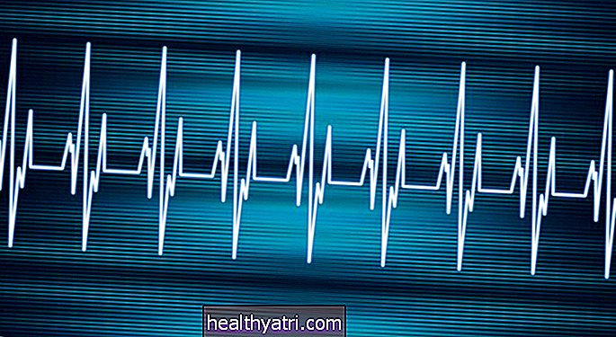Pregled tahikardij in hitrih srčnih ritmov