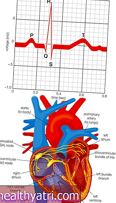 Sistemul electric cardiac și modul în care bate inima