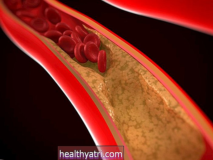 Il ruolo delle arterie nel sistema circolatorio