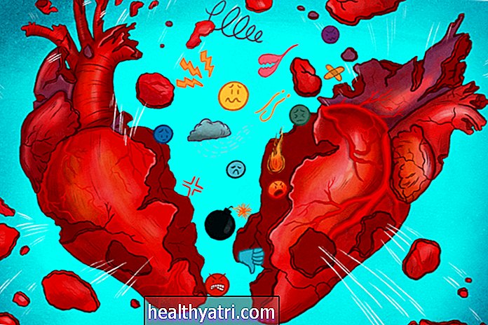 Kas ir salauztās sirds sindroms?