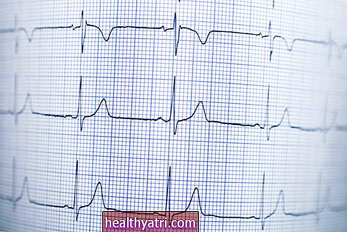 Срце Здравља - Шта треба знати о азитромицину