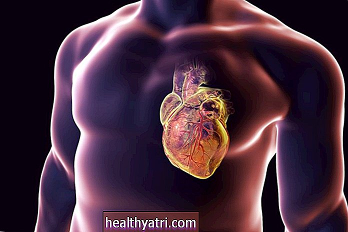 Zašto je važna anatomija koronarnih arterija