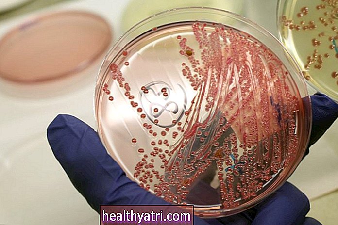 Kaip mikrobai priverčia žmones sirgti hepatitu?