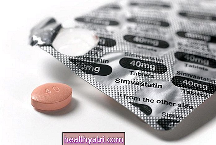 6 receptiniai vaistai, kurių reikia vengti gydant ŽIV