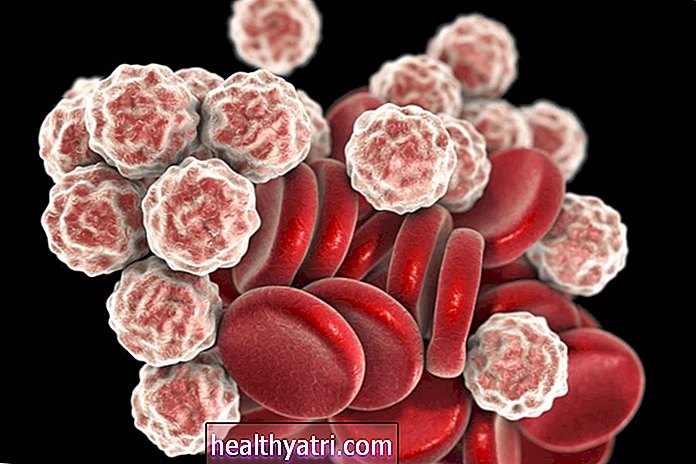 HIV e sua contagem sanguínea completa (CBC)