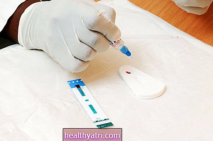 Význam negatívneho testu na HIV