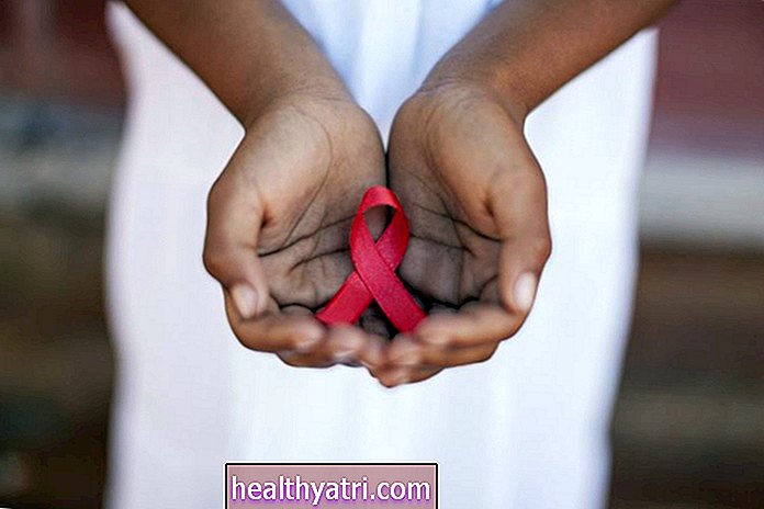 10 parimat HIV-heategevust, mis väärivad teie tuge