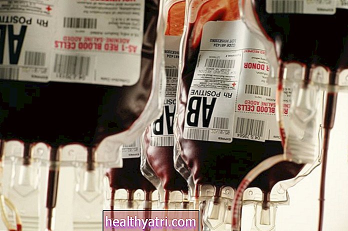 Infecciones por transfusión de sangre