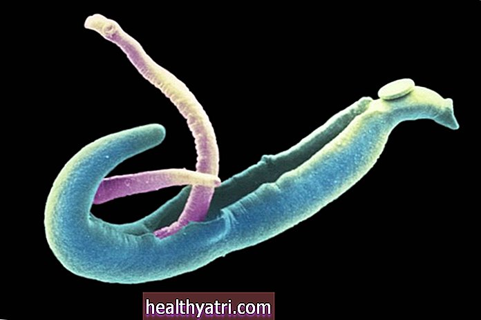 Šistosomiāzes slimības simptomi un ārstēšana
