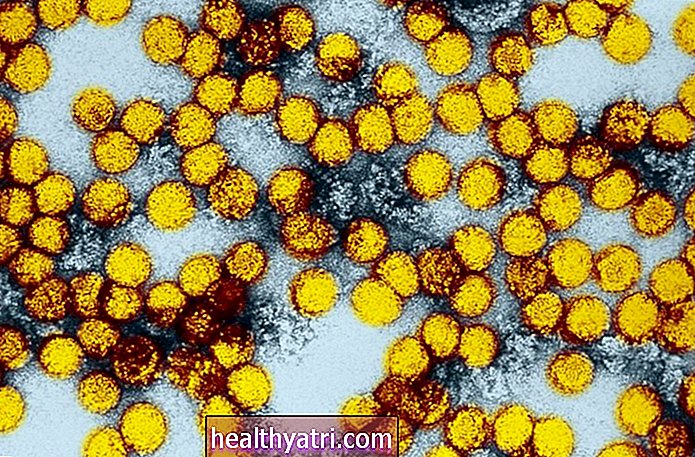 Типы вирусных геморрагических лихорадок