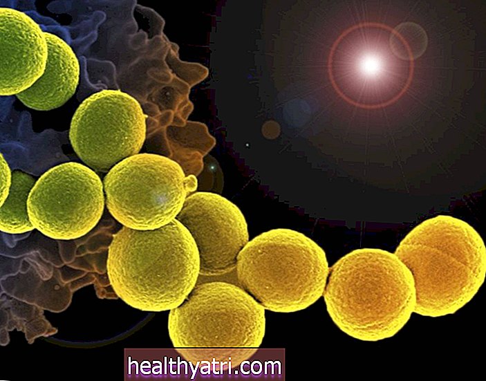Kas yra „Superbug“ infekcija?