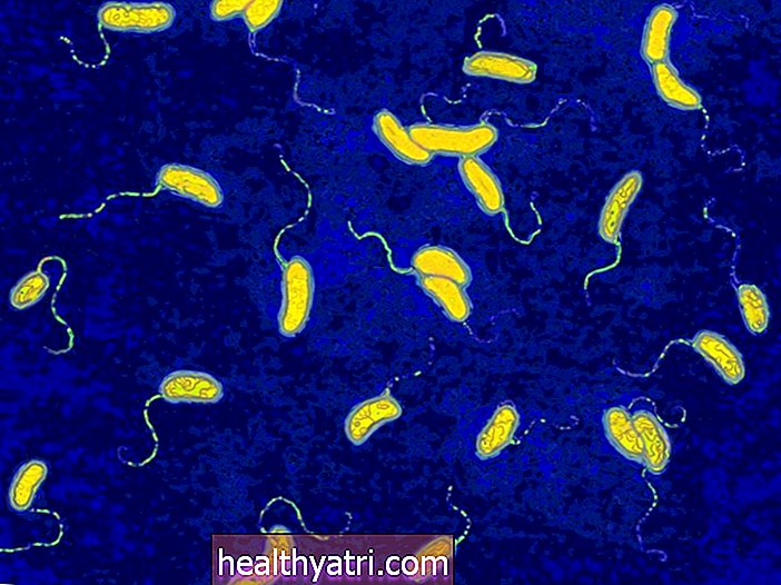 Kas ir holera?