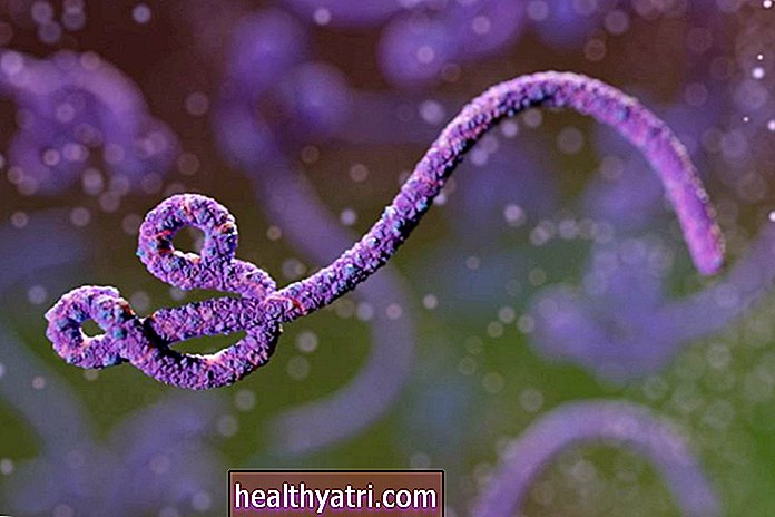 Kas ir Ebola?