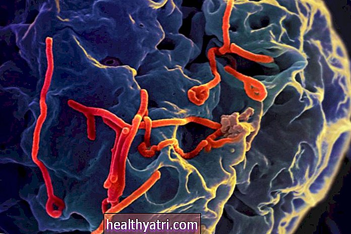 Mis on Lääne-Niiluse viirus?