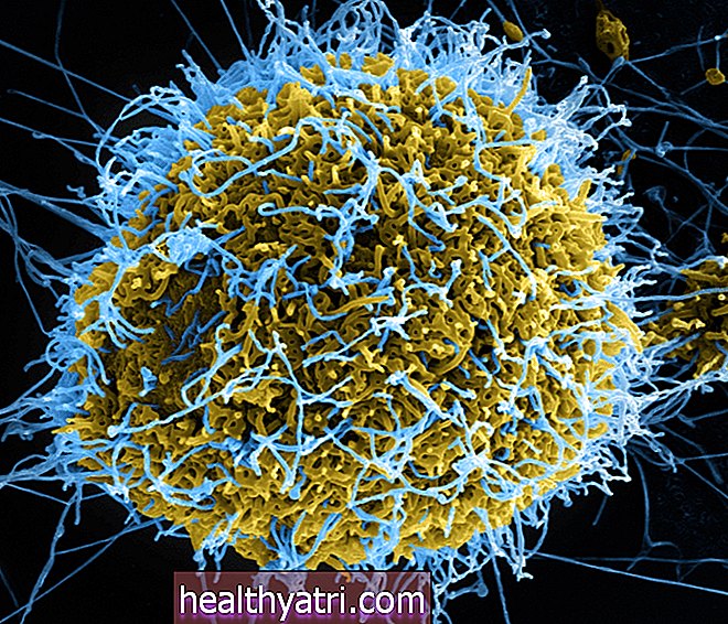 Hva er gul feber?