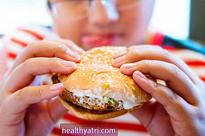 Kaip greito maisto valgymas daro įtaką paauglių sveikatai