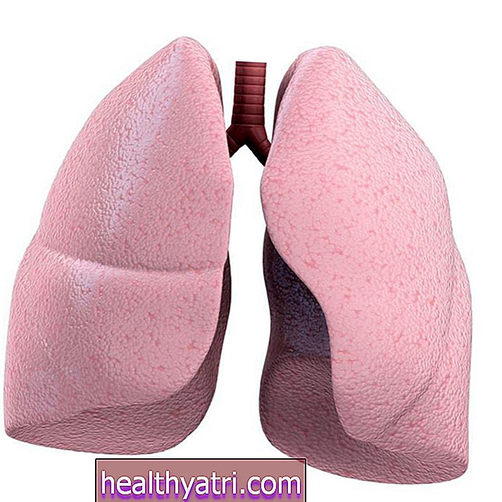 Hilum paru-paru: Anatomi dan Keabnormalan