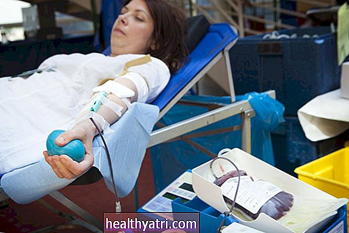 Donación de sangre con lupus