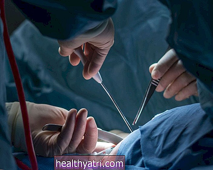 Svorio metimo chirurgija širdies nepakankamumui išvengti