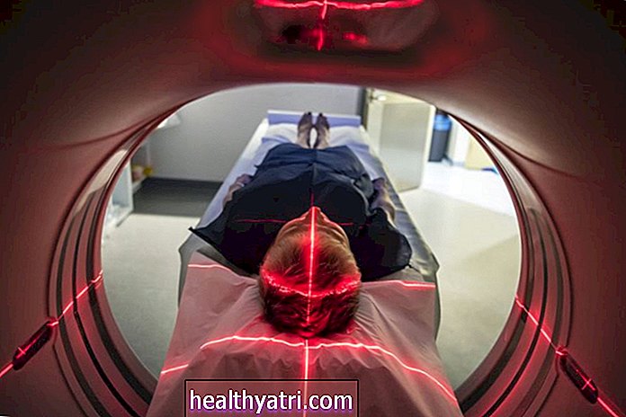 Diagnostika poranenia kolena pomocou MRI