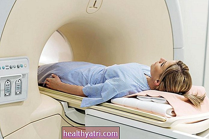 Trebate li magnetnu rezonancu ili rendgen prije početka fizikalne terapije?
