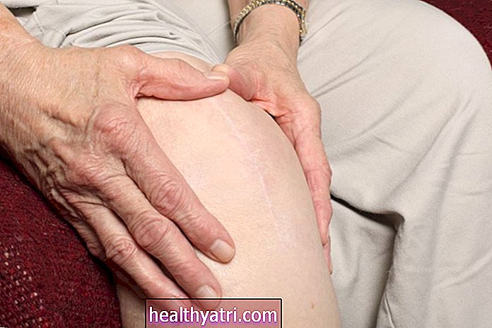 Necitlivost kůže po operaci náhrady kolene