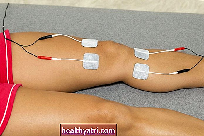 Elektrinės stimuliacijos rūšys, naudojamos kineziterapijoje