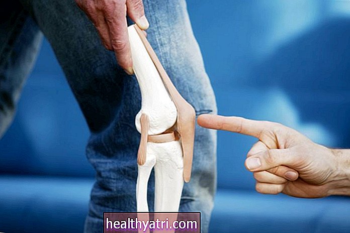 Kakšne so akutne poškodbe pogačice (kolena)?