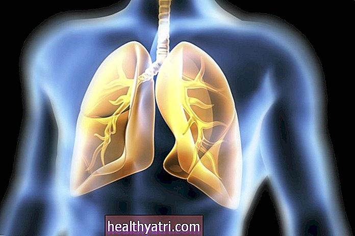 Idiopatinės plaučių fibrozės (IPF) tyrimų pažanga