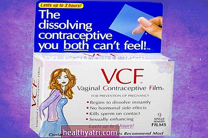 Makšties kontraceptinių plėvelių (VCF) apžvalga
