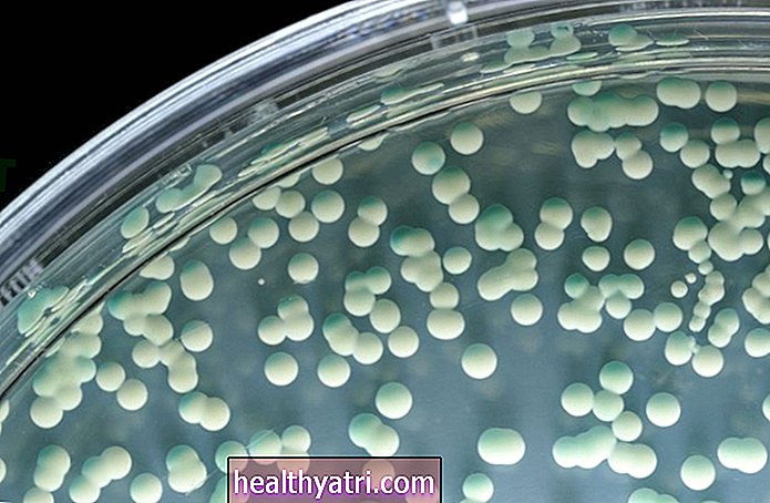 ¿Son contagiosas las infecciones por hongos?
