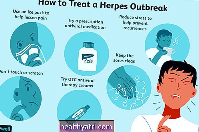 Učinkoviti tretmani za herpes