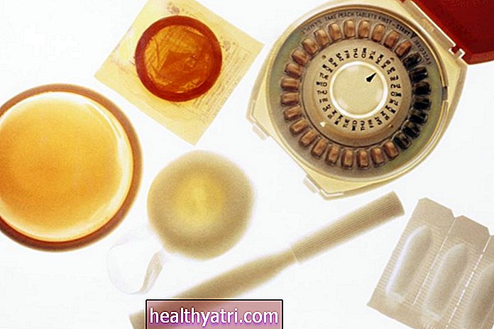 Čimbenici koje treba uzeti u obzir pri odabiru metode kontracepcije