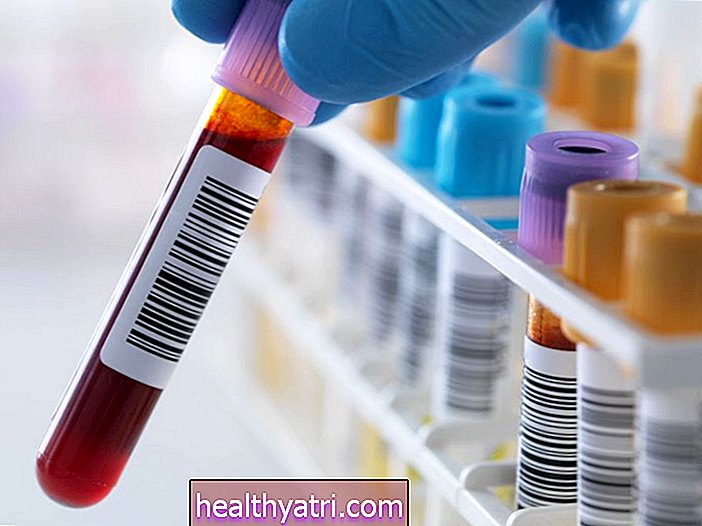 La precisione di un esame del sangue per l'herpes