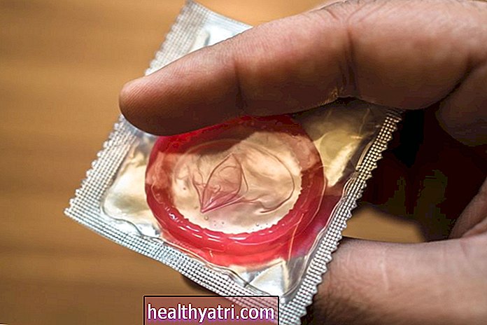 Top 10 kondommyter