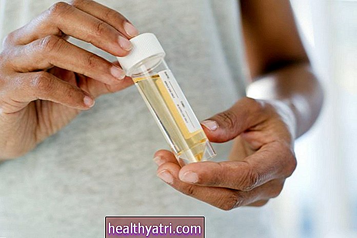 यौन संचारित रोगों के लिए मूत्र परीक्षण