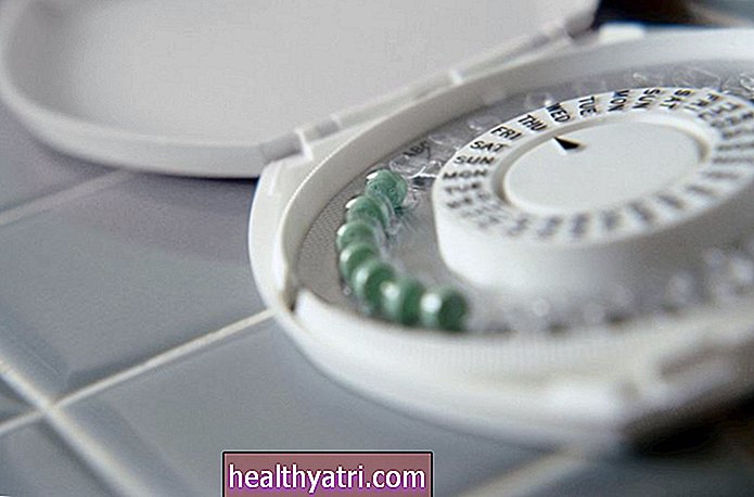 Qué hacer si olvidó tomar su píldora anticonceptiva