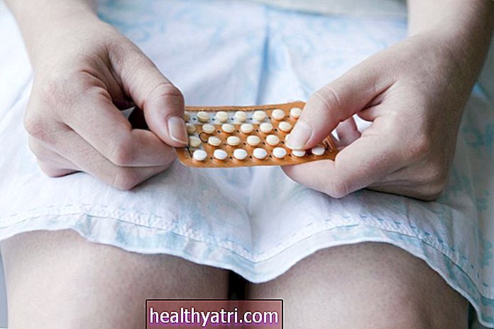 Ką daryti, jei praleidote kontraceptines tabletes