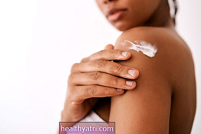Los mejores tratamientos para la infección de la piel por tiña versicolor