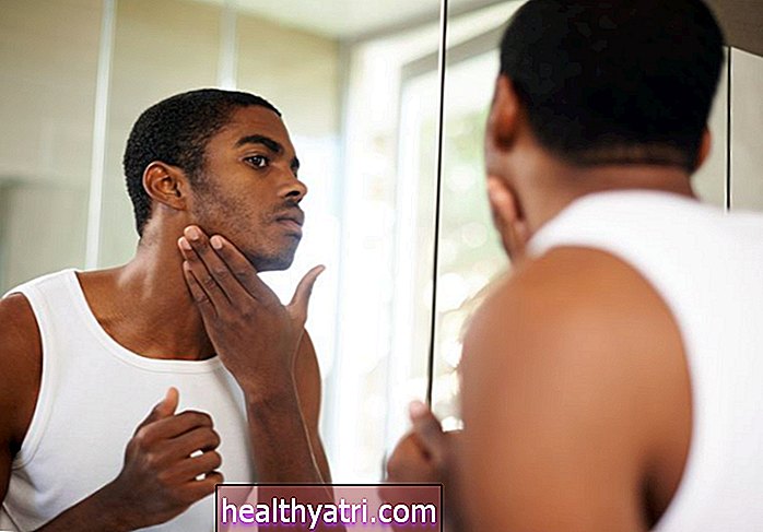 Causas y factores de riesgo del acné