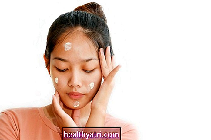 Velge en acne spot behandling