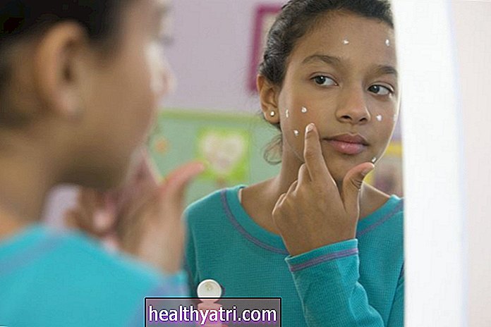 Proactiv funciona para limpar a acne?