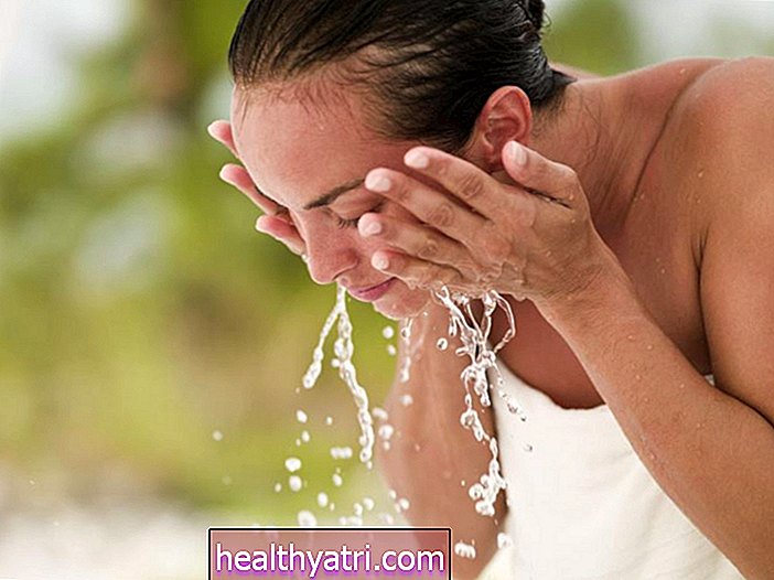 ¿Con qué frecuencia debe lavarse la cara si tiene acné?