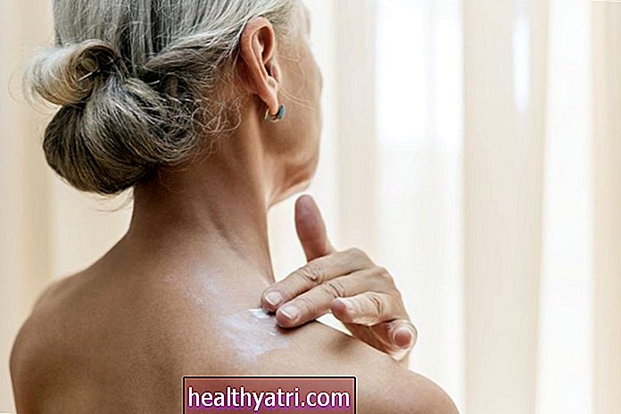 Kako liječiti akne na leđima i tijelu