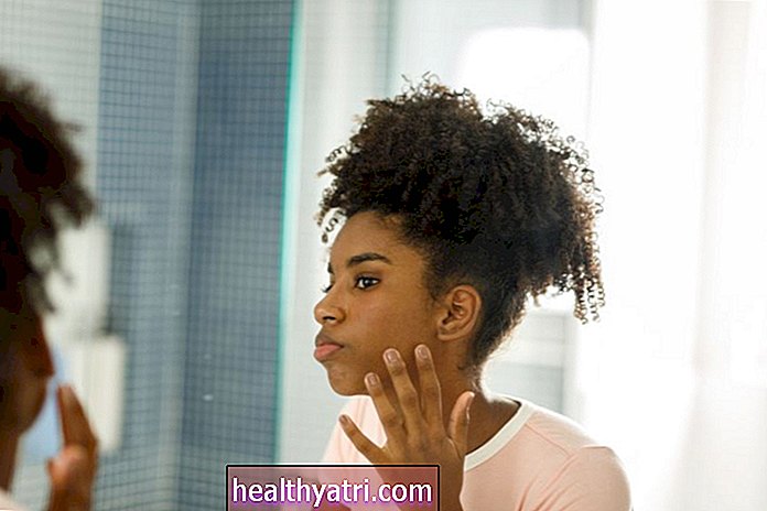 Causas y tratamiento del acné inflamatorio