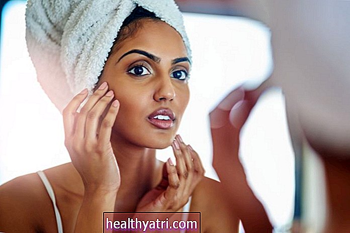Los 4 tipos diferentes de espinillas inflamadas del acné